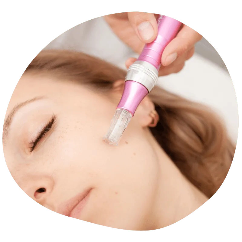 Mesoterapia facial en Benidorm
