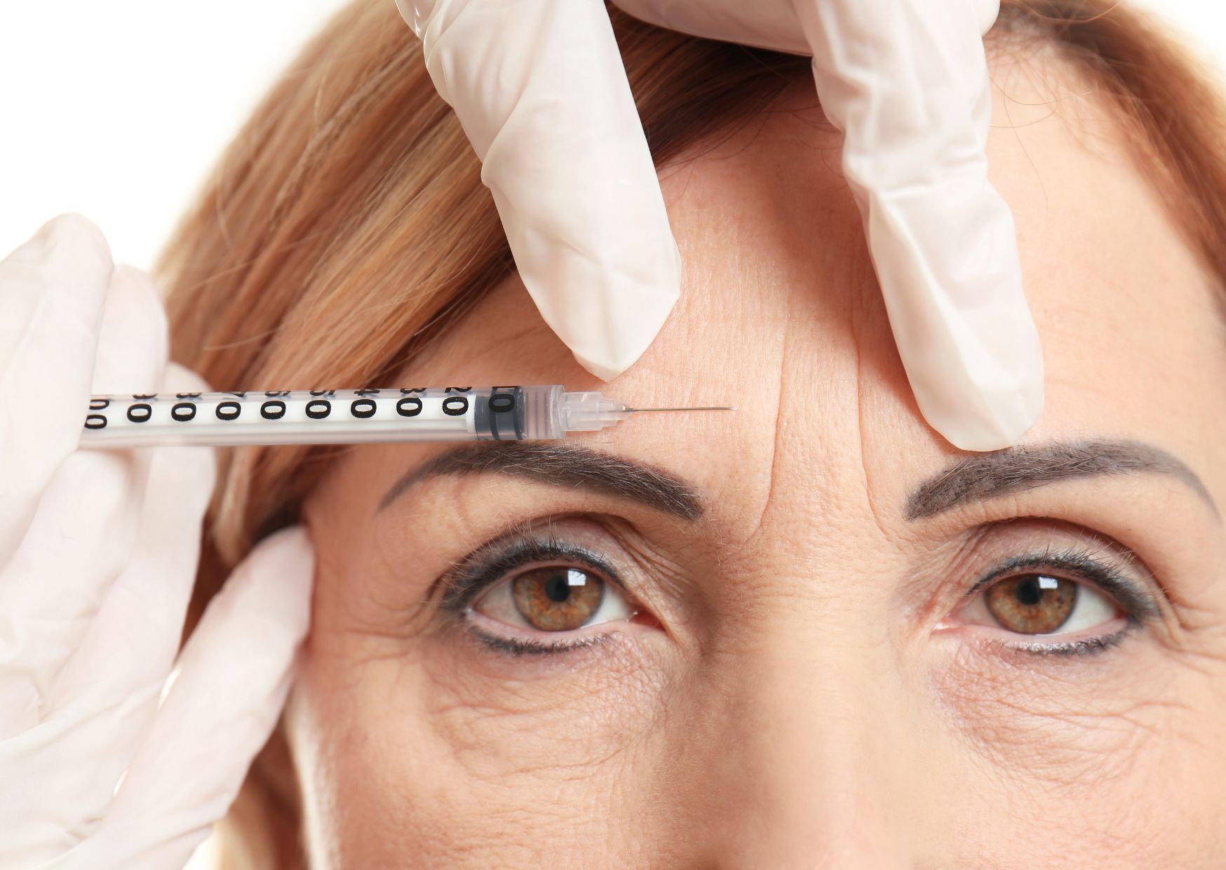 Neuromoduladores en Benidorm: todo lo que debes saber